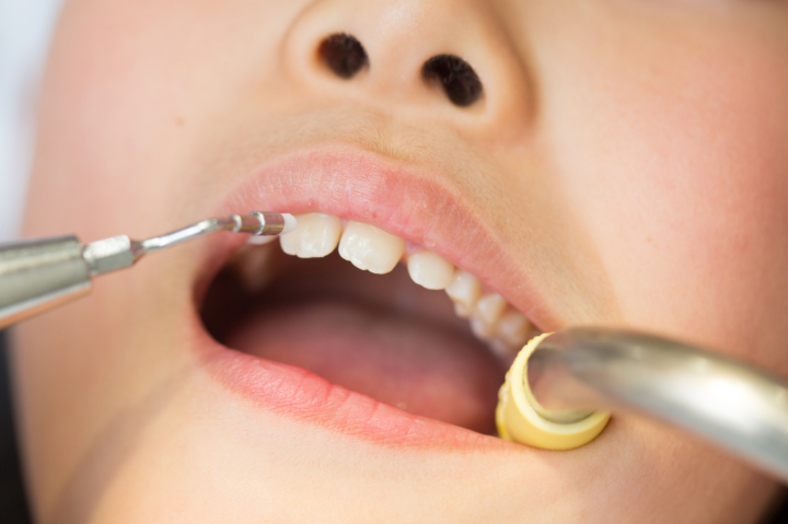 歯科医院での定期検診の様子